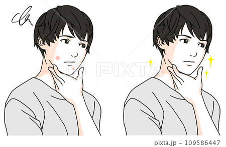 ニキビに悩む男性のビフォーアフターのイラスト2 109586447