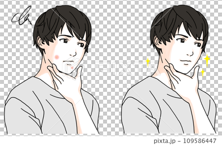 ニキビに悩む男性のビフォーアフターのイラスト2 109586447