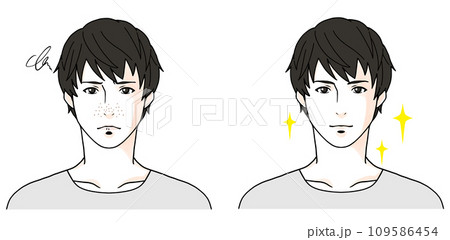 毛穴に悩む男性のビフォーアフターのイラスト1 109586454