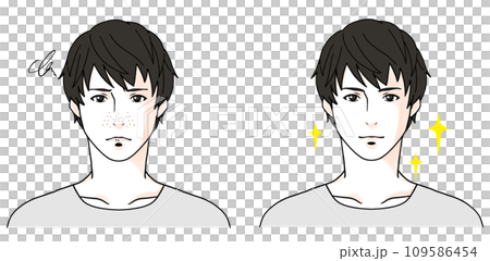 毛穴に悩む男性のビフォーアフターのイラスト1 109586454