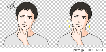 Before and after illustration of a man suffering from oiliness 3 109586461