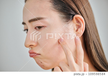 肌のシワやにきびを気にする30代女性 109598584