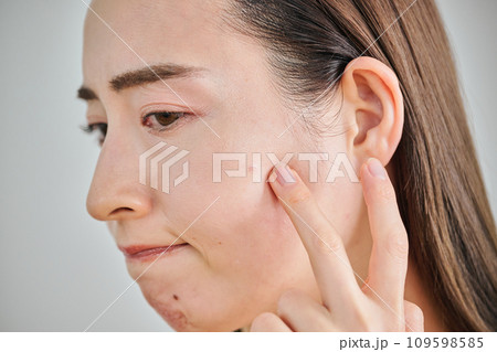 肌のシワやにきびを気にする30代女性 109598585