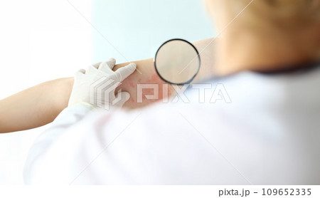 Gloved hands of professional dermatologist Gloved hands of professional dermatologist 109652335