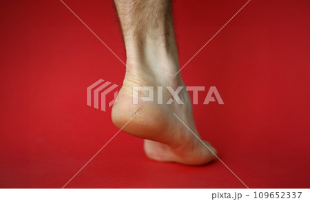 Dry leg of woman 109652337