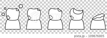 Image illustration of the progression of tooth decay, simple line drawing Image illustration of the progression of tooth decay, simple line drawing 109676805