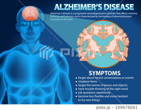 Informative poster of Alzheimers disease Informative poster of Alzheimers disease 109678081