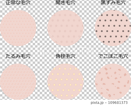 肌表面から見た毛穴のイラストセット 109681373
