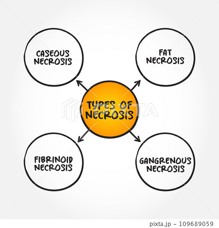 Types of Necrosis (death of body tissue) mind map text concept for presentations and reports 109689059