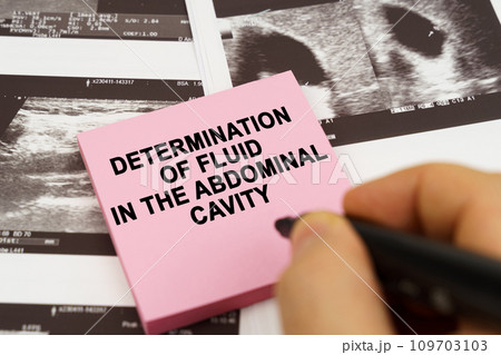 On the ultrasound pictures there are stickers that say - determination of fluid in the abdominal cavity On the ultrasound pictures there are stickers that say - determination of fluid in the abdominal cavity 109703103