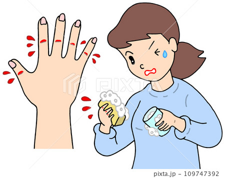 病気・疾病 - あかぎれ・ひび割れ・亀裂性湿疹 109747392