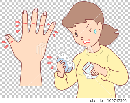 疾病/疾病 - 乾裂/破裂/破裂的濕疹 疾病/疾病 - 乾裂/破裂/破裂的濕疹 109747393