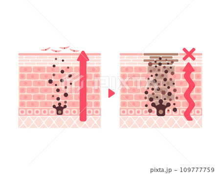 健康な皮膚としみの発生した皮膚のターンオーバー比較イラスト 109777759