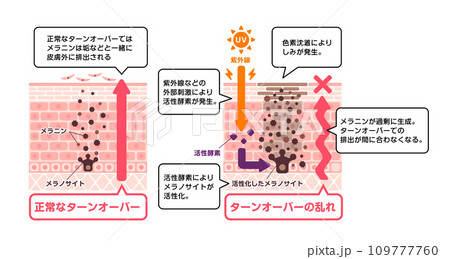 しみの発生メカニズム ベクターイラスト(解説文付き) しみの発生メカニズム ベクターイラスト(解説文付き) 109777760