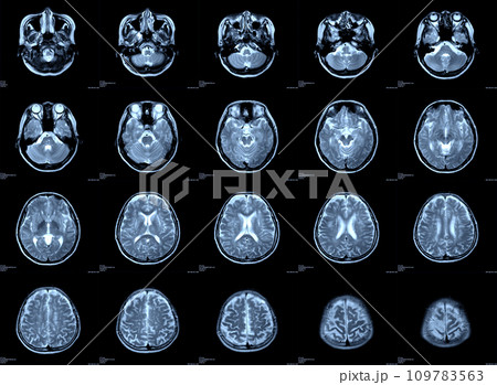 x-ray brain images 109783563