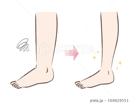 太い足・浮腫んだ足とスリムな足のビフォーアフターのイラスト 109829551