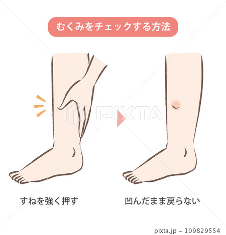 足のむくみをセルフチェックする方法のイラスト 109829554