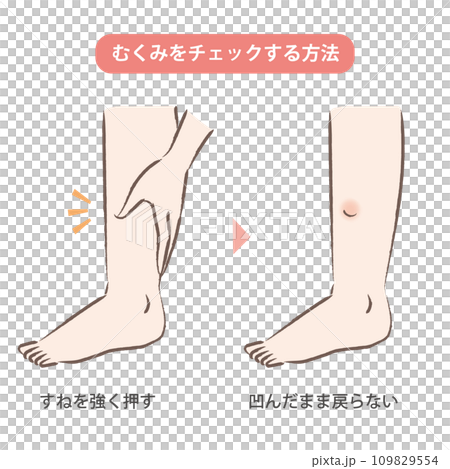 足のむくみをセルフチェックする方法のイラスト 109829554