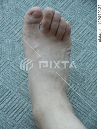 男性の足右 男性の足右 109840122