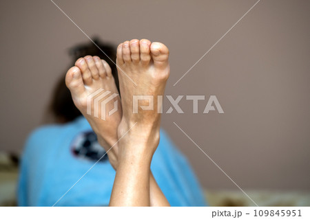 Closeup of woman feet sole with dry cracked skin. Foot and toes care concept. Closeup of woman feet sole with dry cracked skin. Foot and toes care concept. 109845951