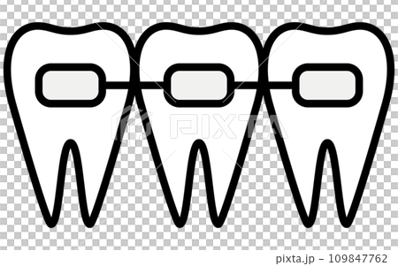 Dentistry: Metal brackets, orthodontic appliances used to correct tooth alignment 109847762