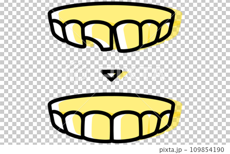 Dental: Direct bonding before and after, simple line drawing Dental: Direct bonding before and after, simple line drawing 109854190
