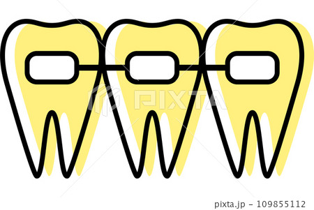 歯科:歯並びの矯正で使う矯正器具、メタルブラケット 歯科:歯並びの矯正で使う矯正器具、メタルブラケット 109855112