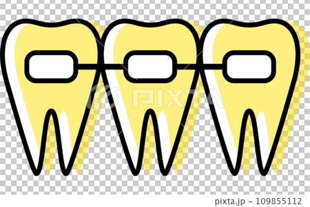 Dentistry: Metal brackets, orthodontic appliances used to correct tooth alignment 109855112