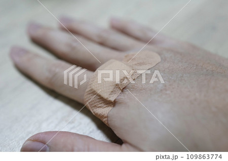 男性の手の甲に絆創膏を貼っている 男性の手の甲に絆創膏を貼っている 109863774