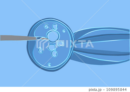 Vector isolated illustration of artificial insemination under a microscope. Donation of egg cells. Egg freezing. Vector isolated illustration of artificial insemination under a microscope. Donation of egg cells. Egg freezing. 109895844