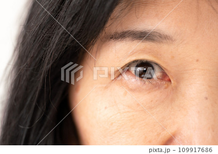 女性　目元　シニア 109917686