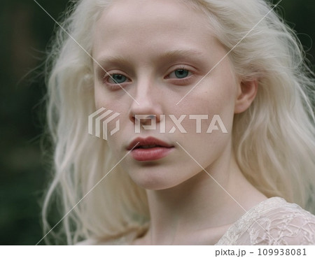 Young albino woman against a background of green nature. Young albino woman against a background of green nature. 109938081