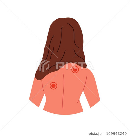 Sick Person Character Set. Woman with influenza and flu symptoms. Characters with fever, headache, and cold. Flat illustrations isolated on white background. 109948249