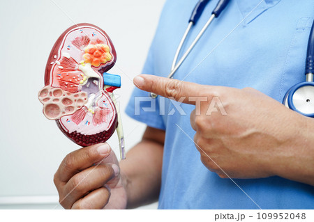 Chronic kidney disease, doctor with model for treatment urinary system, urology, Estimated glomerular filtration rate eGFR. 109952048