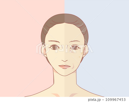 顔に現れる加齢サインのビフォーアフターイラスト	 109967453
