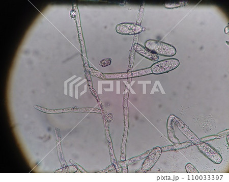 菌糸から伸びるカビの胞子 110033397