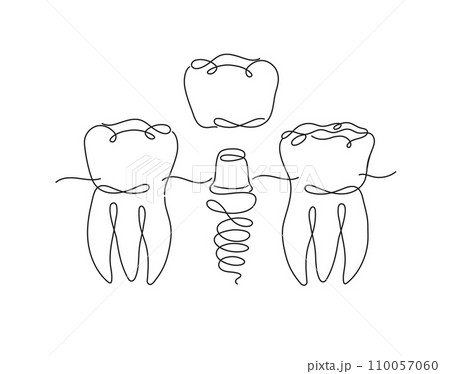 Teeth implant flat line white color Teeth implant flat line white color 110057060