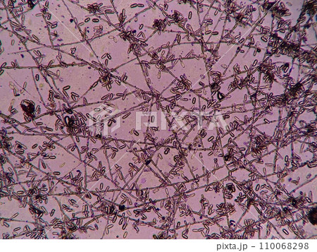 葉っぱの上で広がるうどん粉病を顕微鏡で観察 葉っぱの上で広がるうどん粉病を顕微鏡で観察 110068298