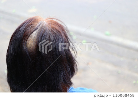 薄毛女性　白髪　日本人 110068459