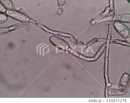 カビの分生子の顕微鏡写真 カビの分生子の顕微鏡写真 110072278