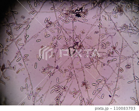 網目状に広がるうどんこ病の菌糸 網目状に広がるうどんこ病の菌糸 110083703
