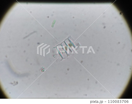 水の中に見えるケイソウ 110083706