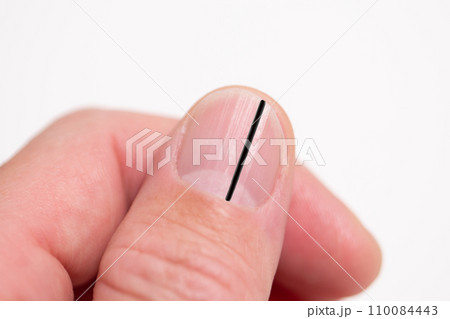 爪に黒い縦線　イメージ 110084443