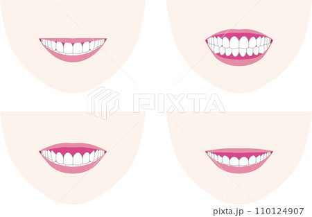 笑顔で歯ぐきが出るガミースマイルなど。笑顔と歯列の見え方のベクターイラスト 笑顔で歯ぐきが出るガミースマイルなど。笑顔と歯列の見え方のベクターイラスト 110124907