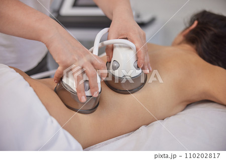medical beauty, body massage, Anti-cellulite. Body massage with vacuum, problem areas slimming, body care professional equipment, low ph massage procedure, anti-cellulite roller vacuum, medical salon 110202817