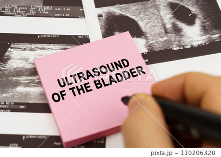 On the ultrasound pictures there are stickers that say - Ultrasound of the bladder On the ultrasound pictures there are stickers that say - Ultrasound of the bladder 110206320