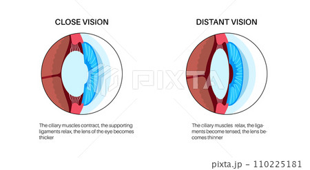 Eye accommodation poster 110225181