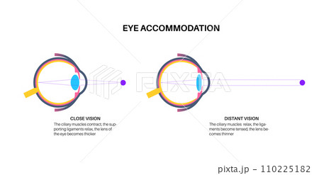 Eye accommodation poster 110225182