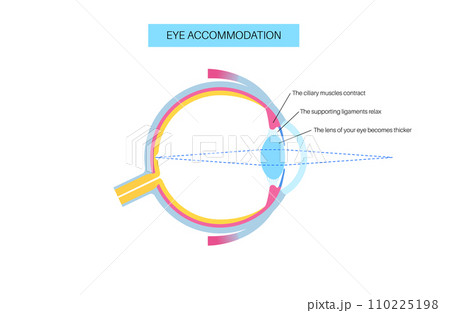 Eye accommodation poster Eye accommodation poster 110225198