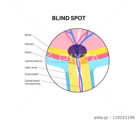 Blind spot poster Blind spot poster 110225199